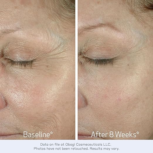 Clinically Proven Eye Cream for Firmer, Youthful-Looking Skin