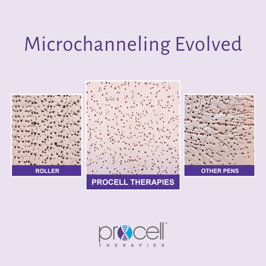 Microchanneling is a more refined technique that uses precision micro-tips to create uniform micro-channels in the skin. This method is less invasive than traditional microneedling, resulting in minimal discomfort and significantly reduced downtime.