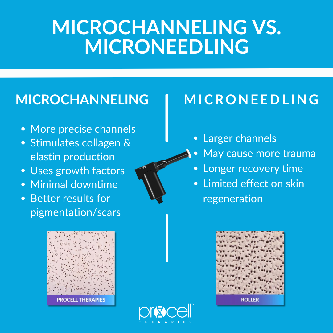 What is the difference between microneedling and microchanneling?