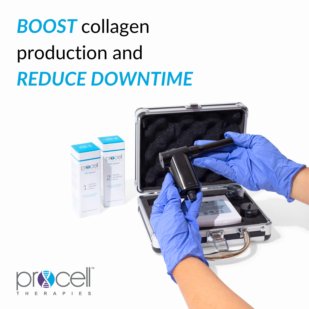 Benefits of Microchanneling - Minimal Downtime: Recovery time is typically just 60-90 minutes, making it a convenient option for those with busy schedules.