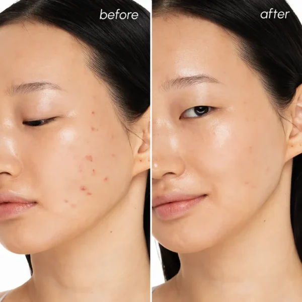 Fragrance-free clearing pads with witch hazel for sensitive skin