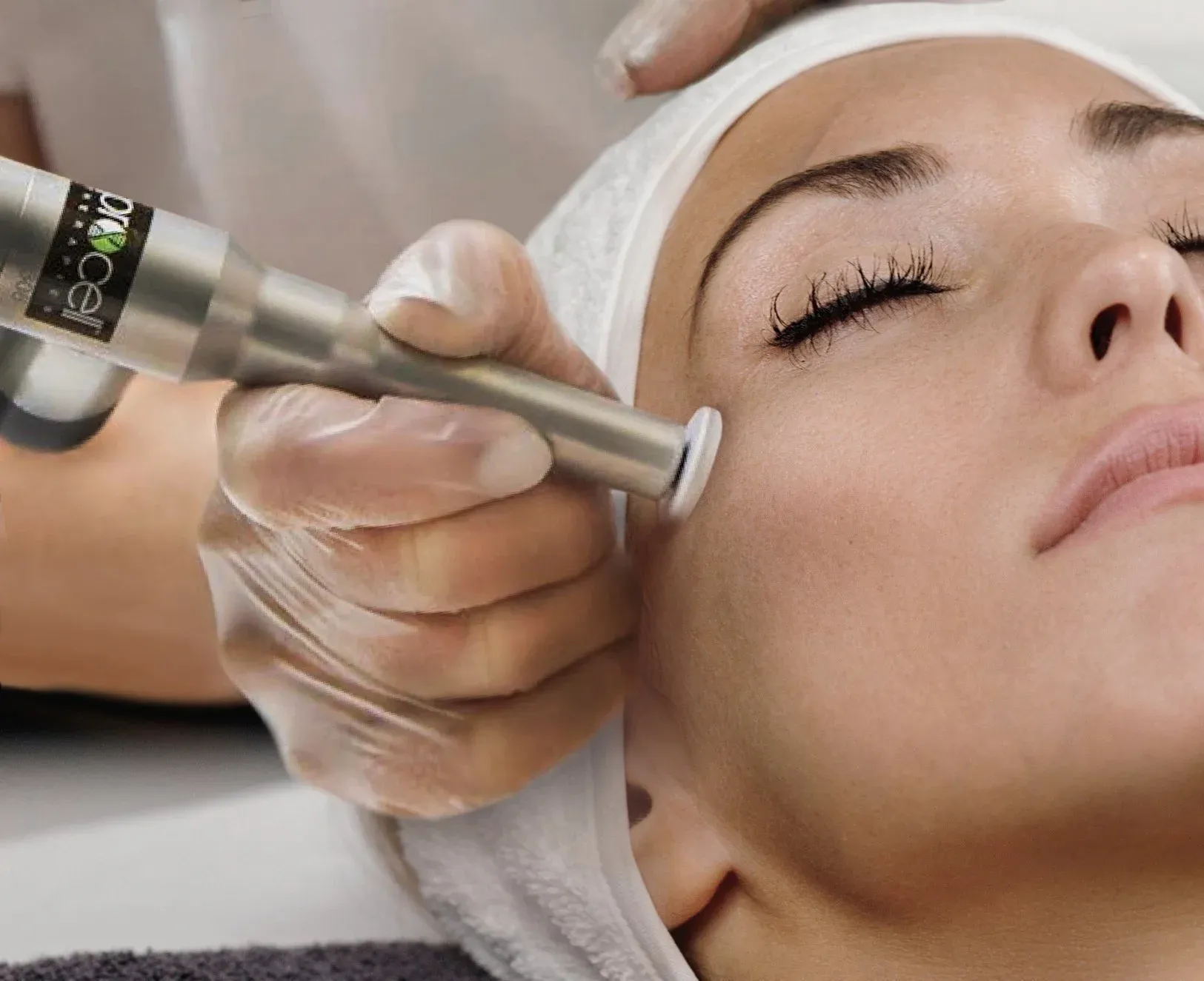 Professional-grade microchanneling tool for estheticians and beauty clinics